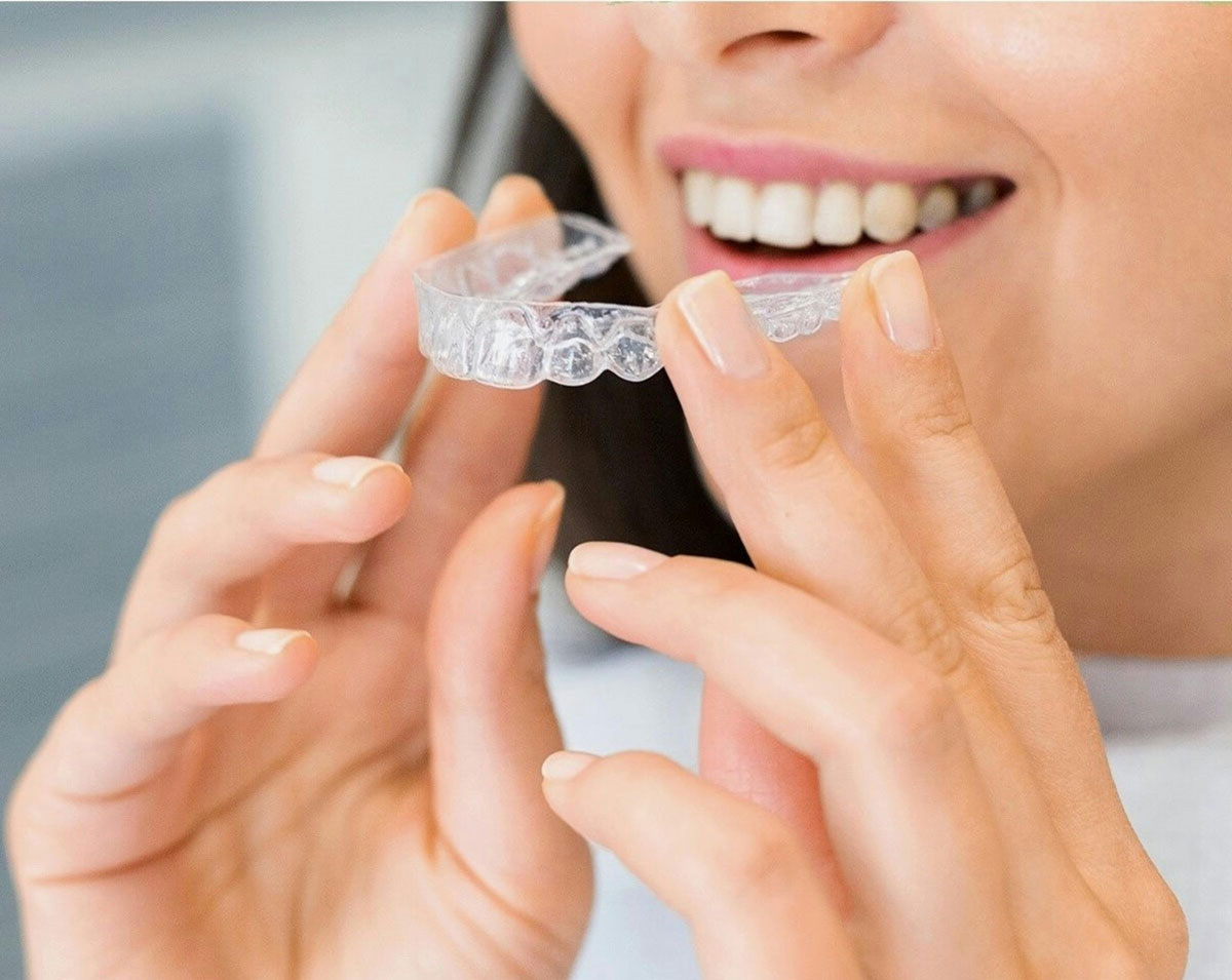 3 Reasons to Choose Professional Teeth Whitening