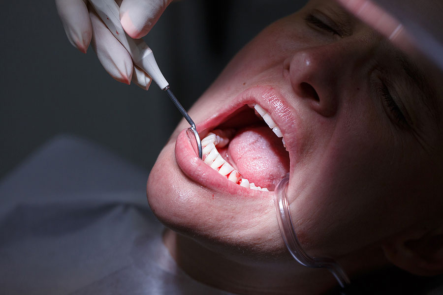 What TMJ Treatment Is Most Common and Why