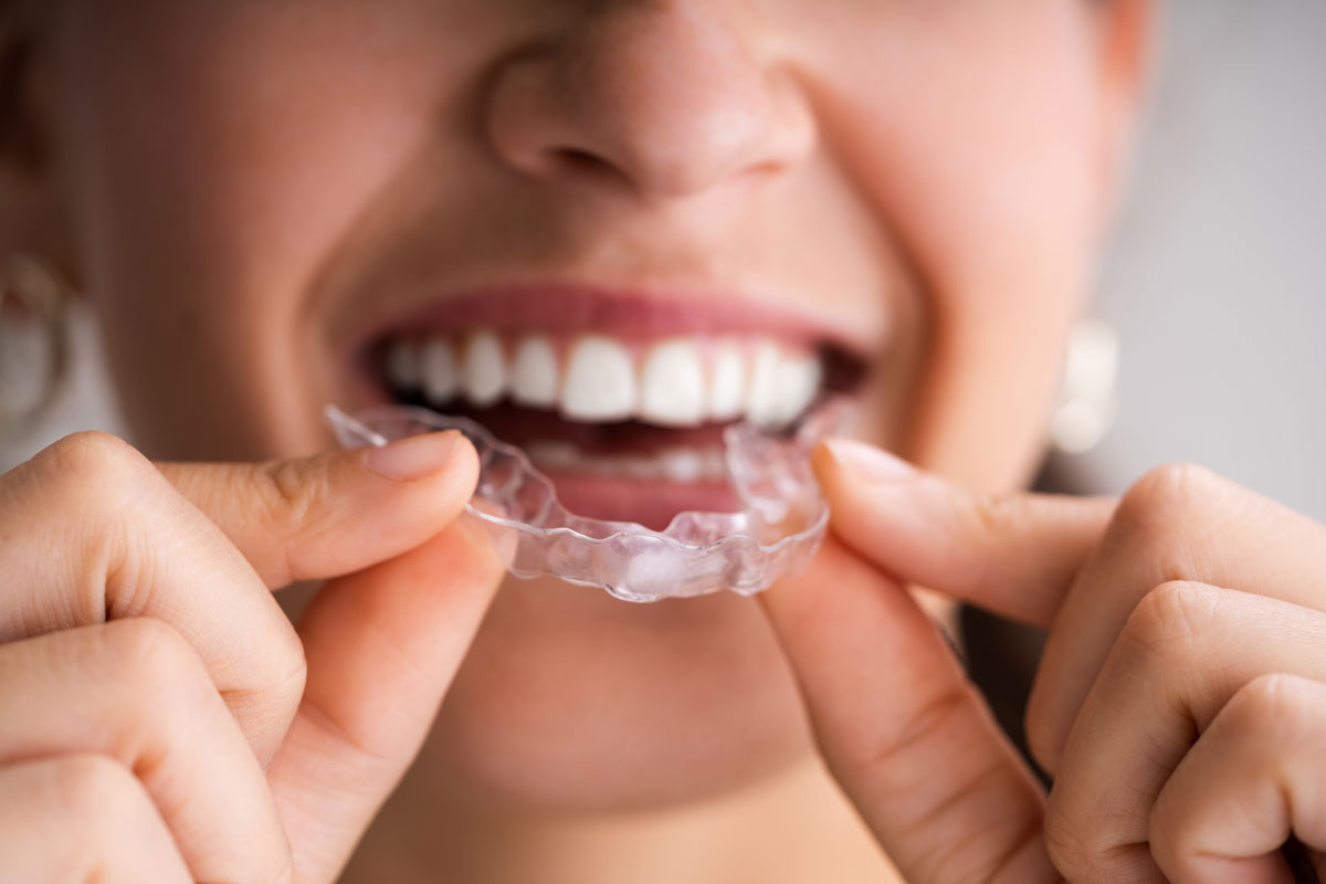 What Happens at My Invisalign Consultation?