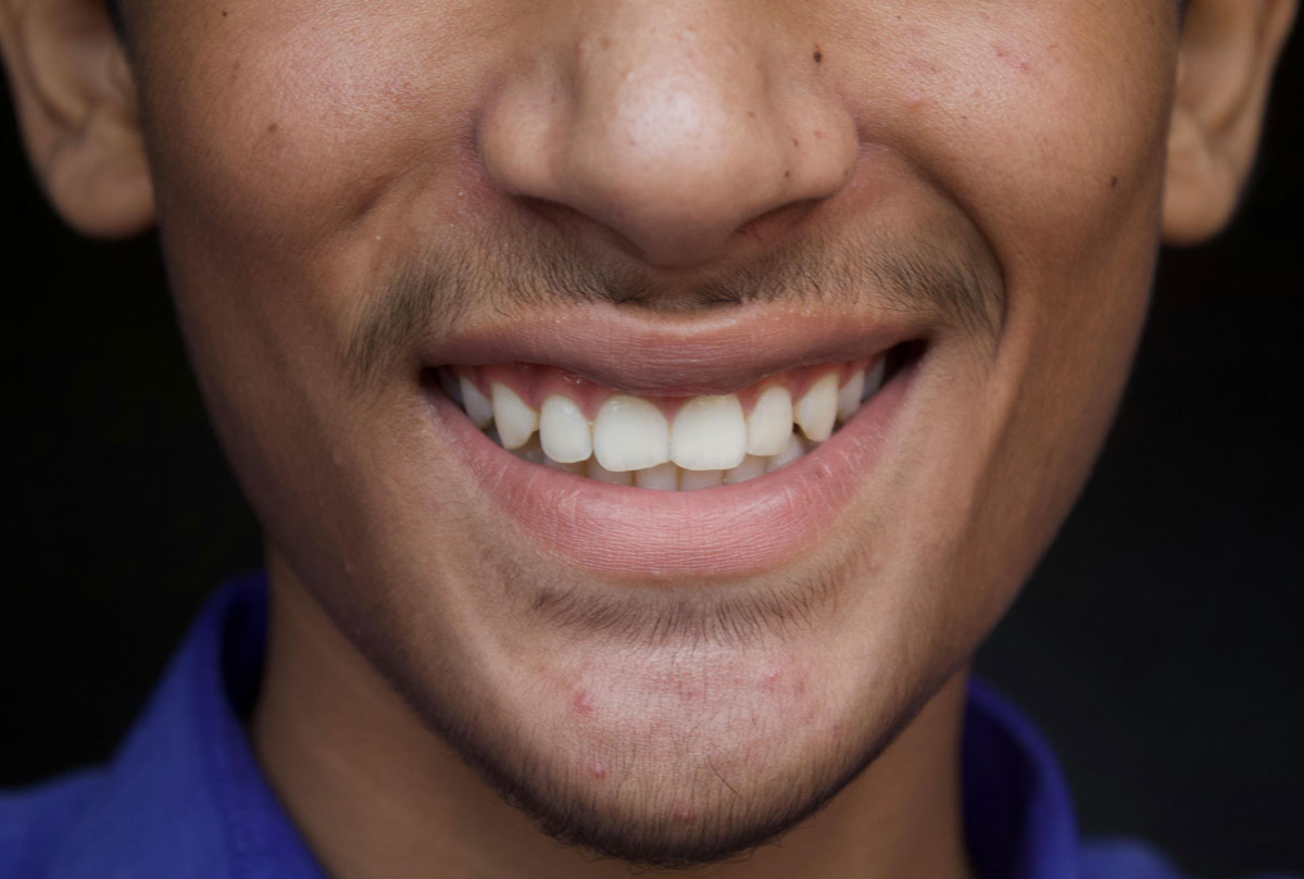 Jaw Pain? It Might Be TMJ…