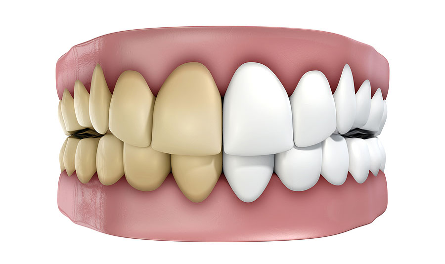 Have You Fallen for Oral Health Misinformation?