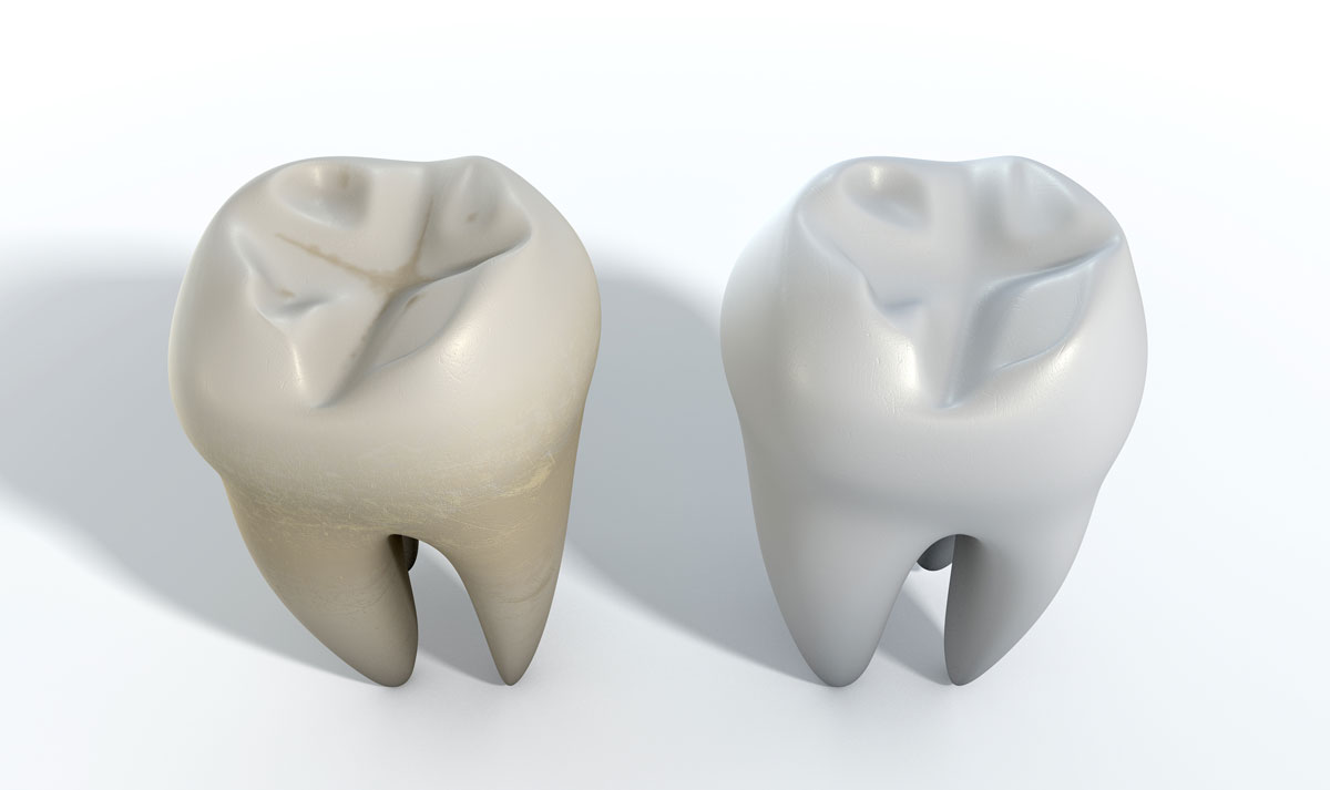 Americans Want to See Their Dentist More