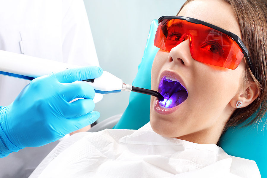 What to Know about Root Canal Treatment in Virginia