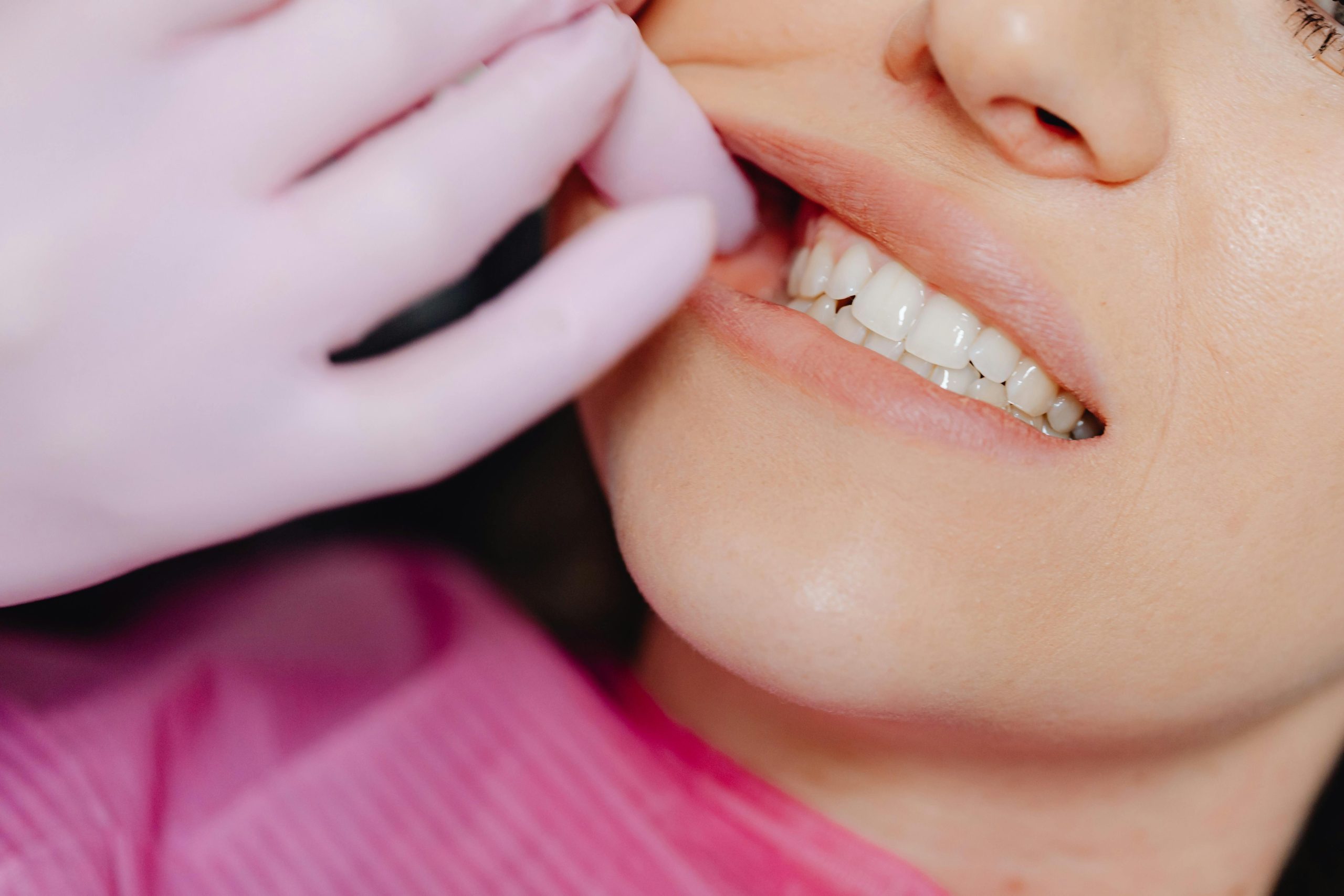 Professional Teeth Whitening vs At-Home Teeth Whitening